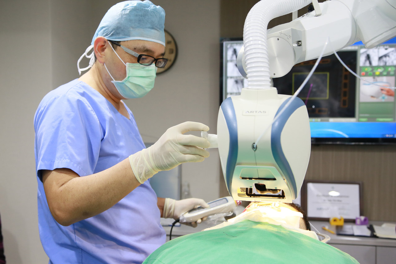 丁元凱,植髮,禿頭,禿髮